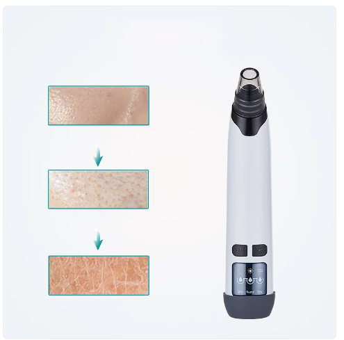 Blackhead Vacuüm Porie-reiniger met Warmte